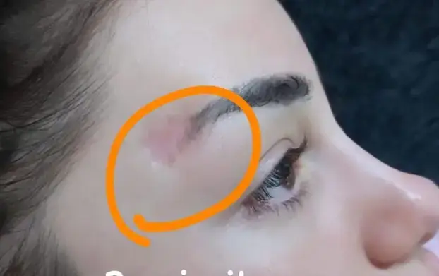 Ovo su žrtve estetskog kirurga iz Zagreba. Htio ih je ušutkati. Stigla mu je prva kazna