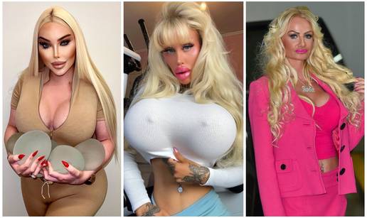 FOTO Mračna strana ovih 'živih' Barbika! Infekcije im 'jedu' kožu i misteriozno umiru. Evo zašto