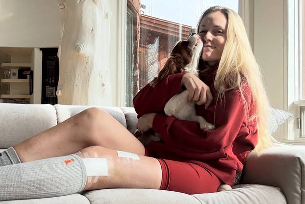 FOTO Vonn u štiklama pokazala isklesano tijelo pa šokirala: 'Gležanj mi je i dalje slomljen'
