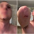 U Medulinu brutalno pretukli dva Slovenca. Uhitili jednog Hrvata (41), tra&zcaron;e jo&scaron; trojicu!