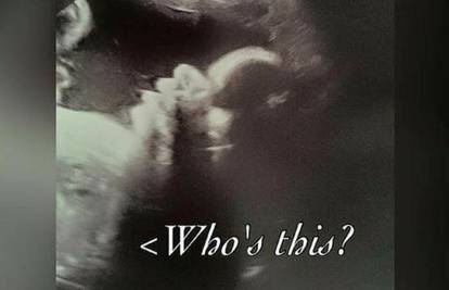 Fotografija bebe s ultrazvuka šokirala buduće roditelje