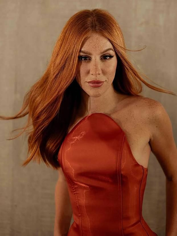 FOTO Posebna ljepota: Milijuni ljudi obožavaju njezine pjegice