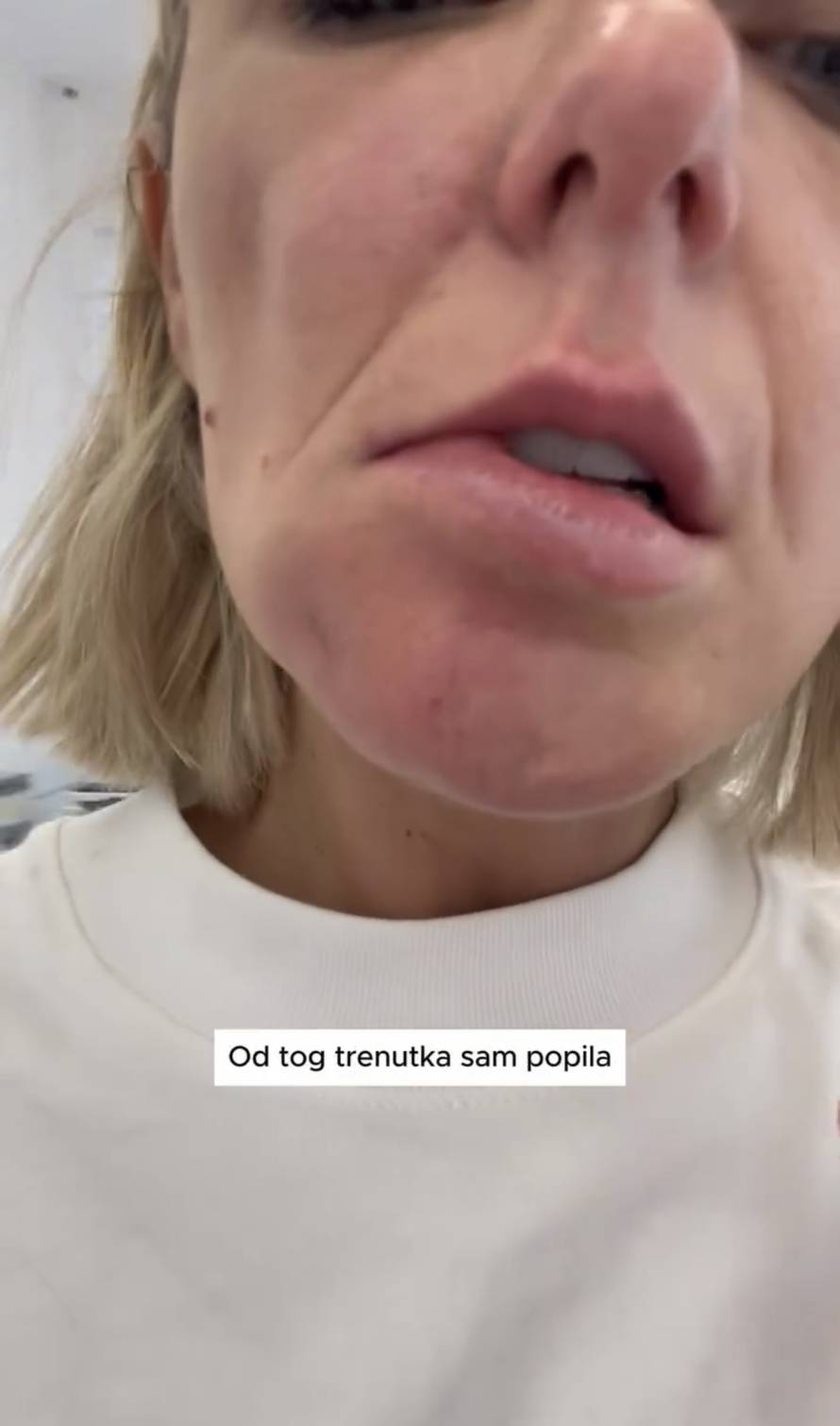 Fileri joj uništili lice: Stankica iz 'Gospodina Savršenog' ponovno je bila na estetskom zahvatu...