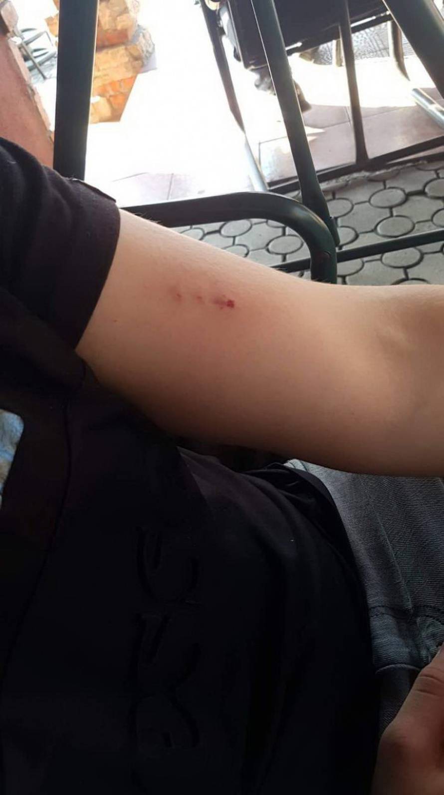 Kondukter ugrizao učenika jer je zaboravio mjesečni pokaz?