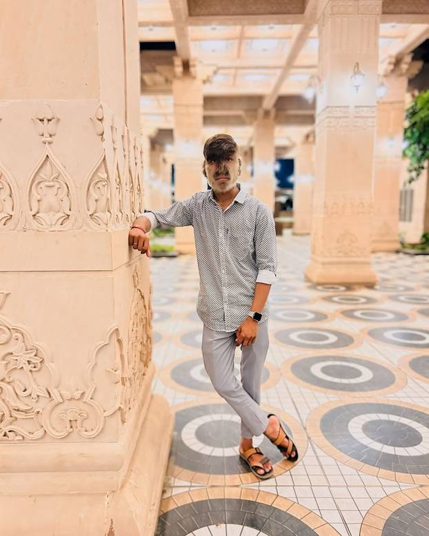 FOTO Ovaj mladić (18) pati od sindroma vukodlaka: U školi me sprdaju, ali volim svoje dlake...