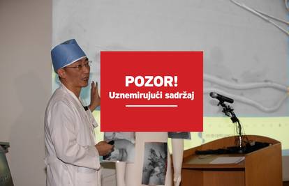 Bori se za život:  U želucu imao do sada nikad  viđene parazite!