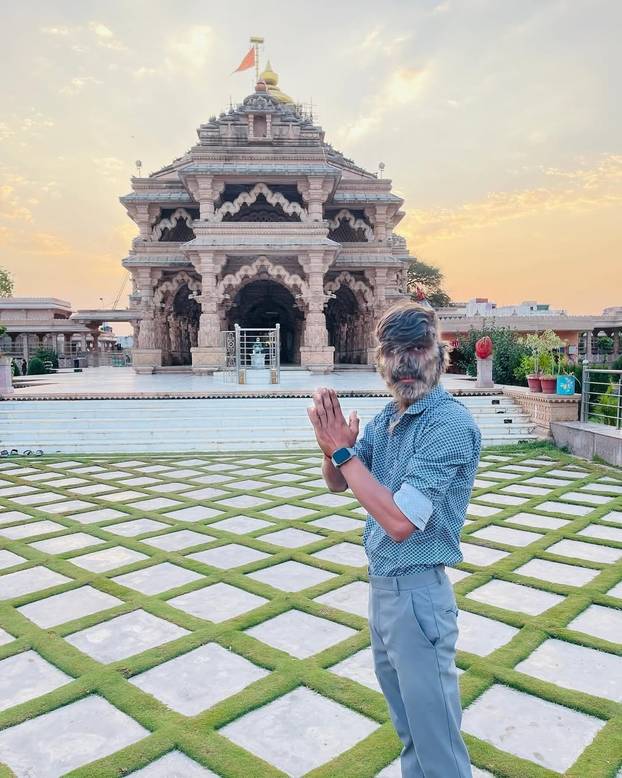 FOTO Ovaj mladić (18) pati od sindroma vukodlaka: U školi me sprdaju, ali volim svoje dlake...