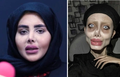 'Zombie' Angelina Jolie pravo lice otkrila je nakon zatvora: Evo kako se uspjela proslaviti...