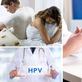 Roditelji se boje cjepiva protiv HPV-a, a ne karcinoma! A umire nam 20% više ljudi od prosjeka