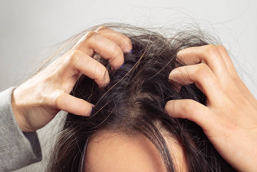 A Young Woman Scratches Her Scalp And Hair With Her Fingers. Hai