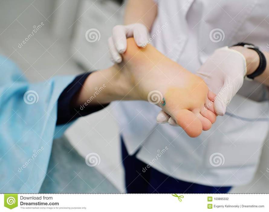 Virusne bradavice ‘vrebaju’ u teretani, vrtićima i bazenima