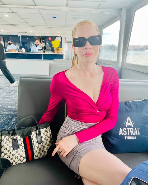 FOTO Afrikanka s albinizmom osvaja modnu industriju: 'Često privlačim znatiželjne poglede'