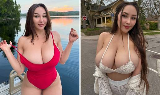 FOTO Ukrajinsku ljepoticu grudi su proslavile, a sada ih &zcaron;eli smanjiti: 'Svi bulje u mene'