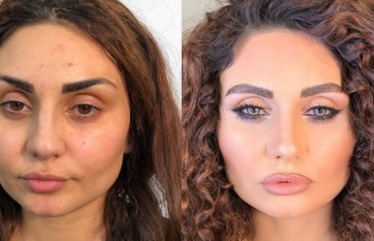 Vizažist šminka žene s ožiljcima: Svaka od njih je prekrasna bez obzira na svoje 'nesavršenosti'