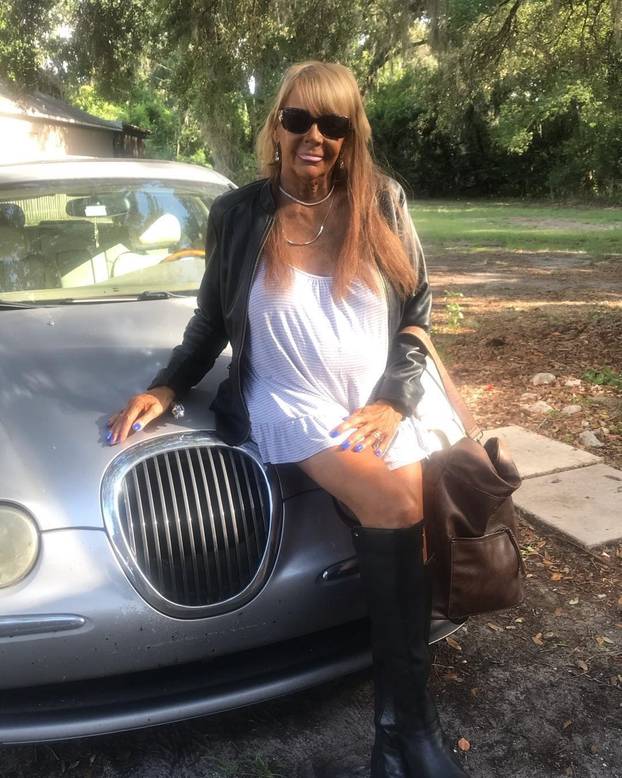 FOTO Ovisna je o solariju. Tamo je vodila i svoju 5-godišnju kćer. 'Kvarcala sam se svaki dan!'