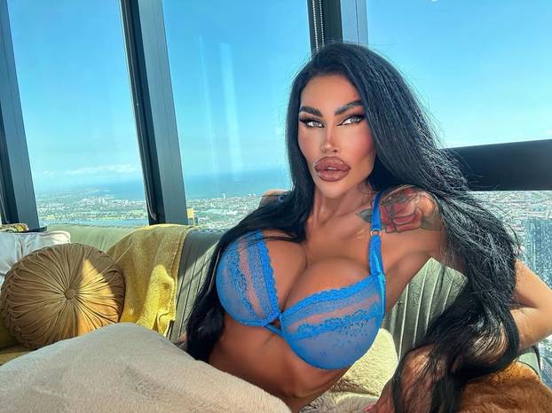 FOTO Potrošila više od 100 tisuća eura kako bi izgledala kao 'ljudska barbika' - Liječnici zgroženi