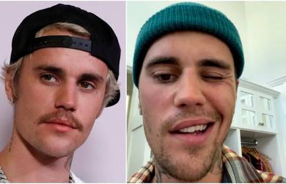 Bieber se nakon paralize lica povukao, ali sad se vraća glazbi
