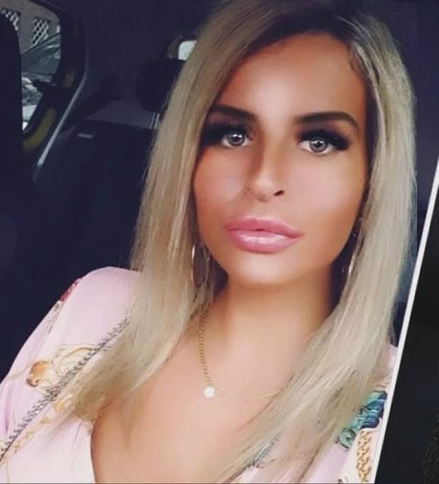 FOTO Uznemirujuće! Uklonila je čak i vrh nosa, a evo kako je izgledala: Šteta, ljepotica si bila