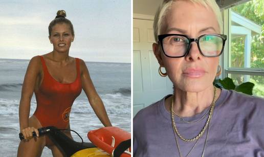 Zvijezda Baywatcha podvrgnula se mastektomiji: Dvije godine se već bori s rakom dojke...