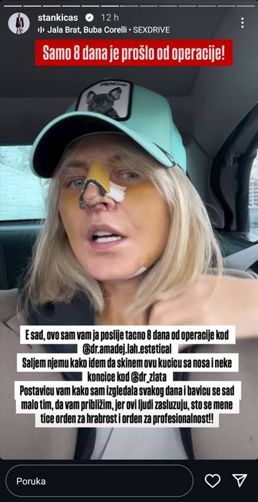 Stankica iz 'Savršenog' uklonila filere: Operacija je trajala 9 sati