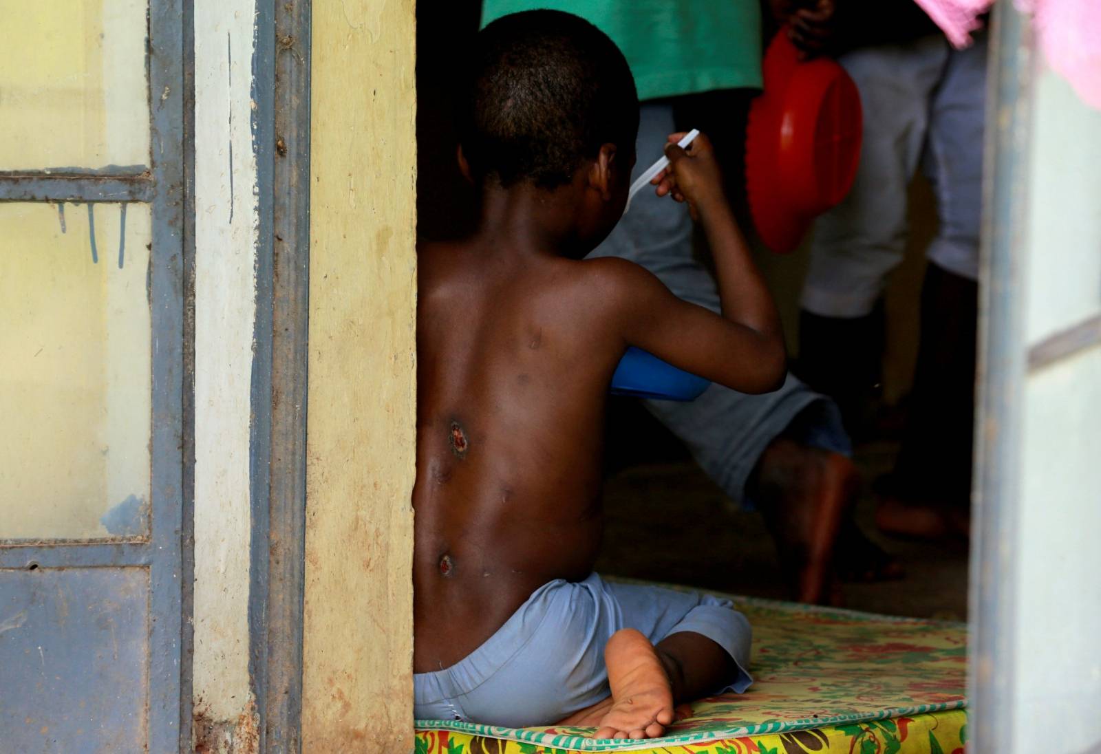 One of the children rescued by police, with bruises on his back, eats at the Hajj transit camp in Kaduna