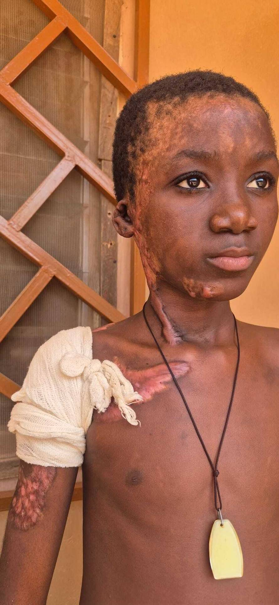 Djevojčice iz Afrike trpe bolove. Pomažu im naše misionarke i doktor s Rebra dok ne stignu tu