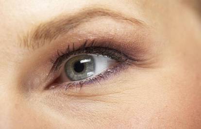 Lijek protiv glaukoma ubrzava rast trepavica