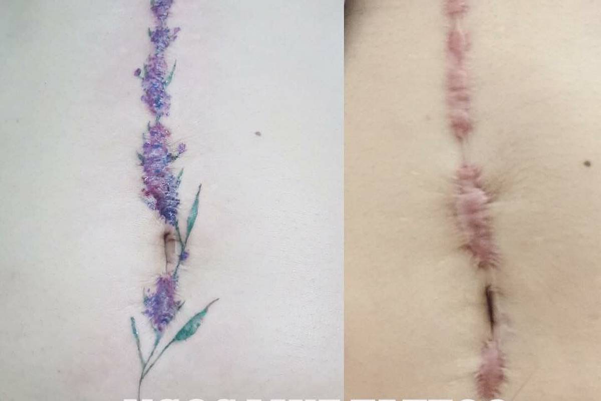 Ljudi joj stižu s ožiljcima, a kući idu s prekrasnim tetovažama