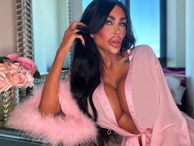 FOTO Potrošila više od 100 tisuća eura kako bi izgledala kao 'ljudska barbika' - Liječnici zgroženi