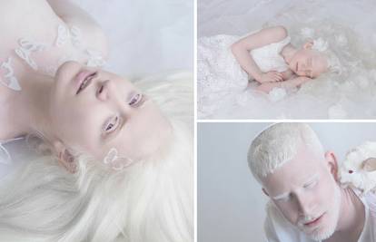 Fotografira albino ljude: 'Oni su nevjerojatni, hipnotički lijepi'