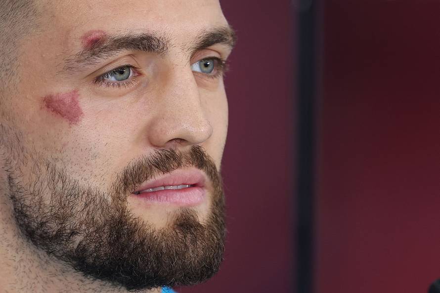 KATAR 2022 - Mateo Kovačić na konferenciji za medije pojavio se s masnicom na licu 