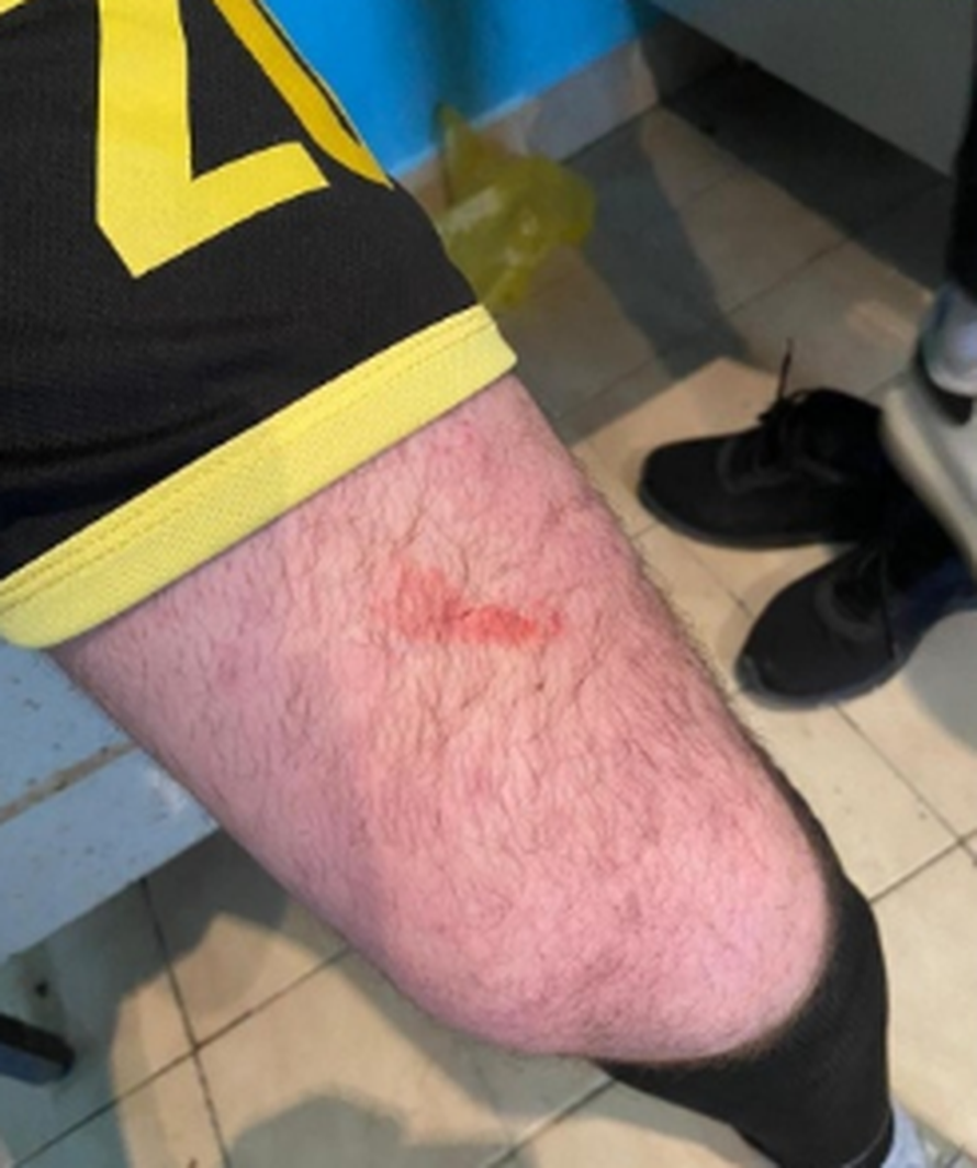 Domaćini pretukli goste jer su poveli u prvom poluvremenu: Uključili se redari i fizioterapeut