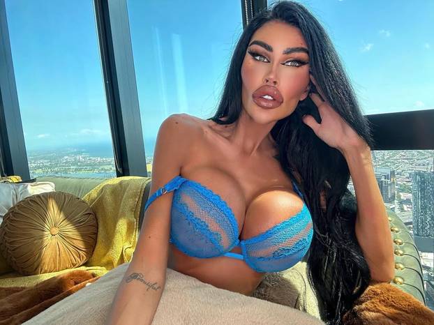 FOTO Potrošila više od 100 tisuća eura kako bi izgledala kao 'ljudska barbika' - Liječnici zgroženi