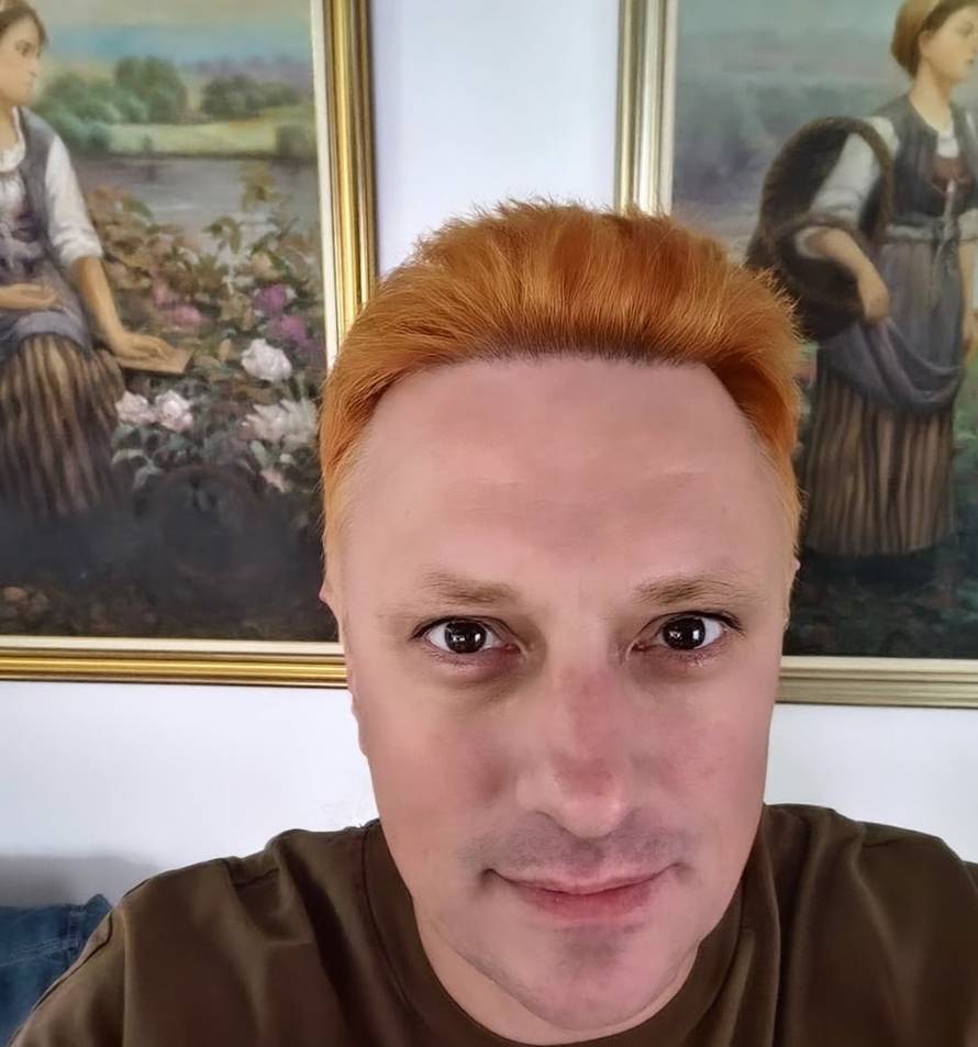 Andrija Milošević napravio je drastičnu promjenu u izgledu: To peče i boli, oko mi je iscurilo