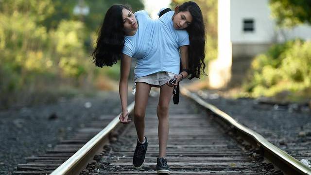 Rare conjoined twins seek ordinary life in extraordinary circumstances
