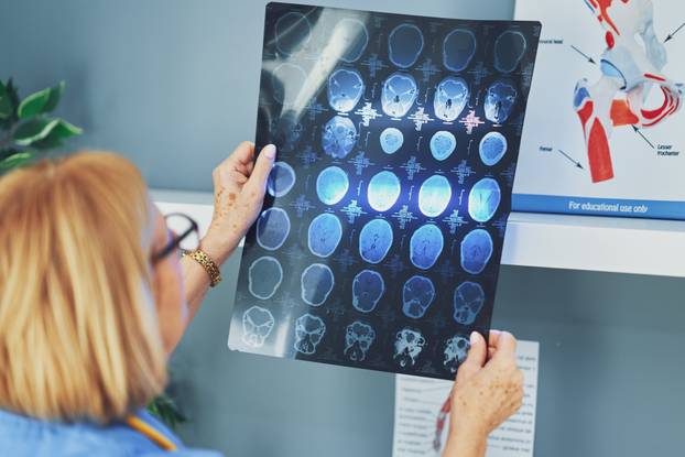 Woman doctor checking diagnosis on film image