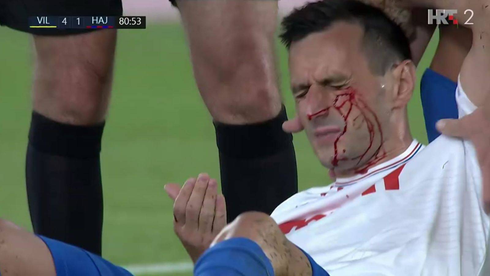 Stoper Villarreala laktom razbio Kalinićevo lice: Sav u krvi izašao već nakon četiri minute