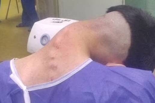 Mladić (23) pati od 'sindroma pale glave' - liječnici misle da je uzrok teška ovisnost o drogama