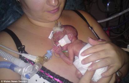 Rodila se prerano: Majka je svoju palčicu nosila na dlanu