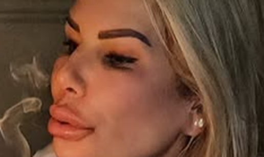 Gazdina k&cacute;i isti&ccaron;e bujne usne, a ovako se mijenjala kroz godine