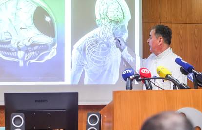 'Djetetu se zabila kost u mozak! Tu je 285% više hospitaliziranih u nesrećama s el. romobilima...'