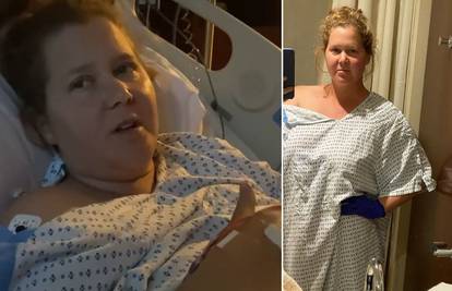 Glumica Amy Schumer: 'Morala sam izvaditi maternicu i  slijepo crijevo zbog endomtrioze'