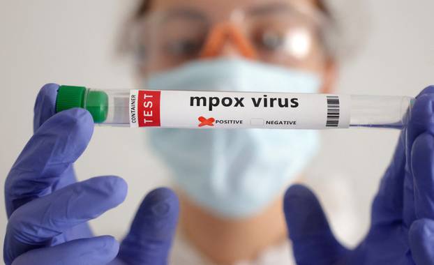 Illustration shows test tubes with "Mpox virus positive" label