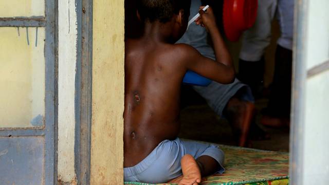 One of the children rescued by police, with bruises on his back, eats at the Hajj transit camp in Kaduna