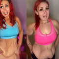 Pokazala kako joj izgleda tijelo nakon što je izgubila više od 100 kg: Ne mora vam se sviđati