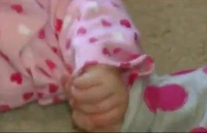 Blizanke se čak i šest mjeseci nakon rođenja drže za ručice