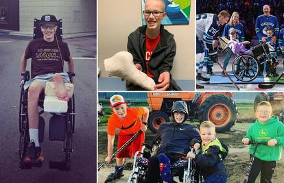 Dječak zbog raka izgubio nogu, koljeno mu napravili od stopala
