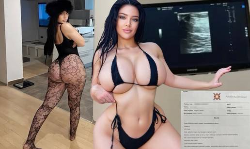 FOTO Bujnoj Slavonki ne vjeruju da ima prirodne grudi. Poslala je dokaz: 'Evo vam ultrazvuk!'