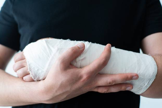 A healthy hand of a young man supports a wounded broken arm in a plaster bandage close-up. The difficulty of self-movement of the hand at a fracture