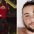 Sjećate li se Lea iz 'X Factora'? Pao je s visine od 20 metara i teško stradao: Nekako sam živ!